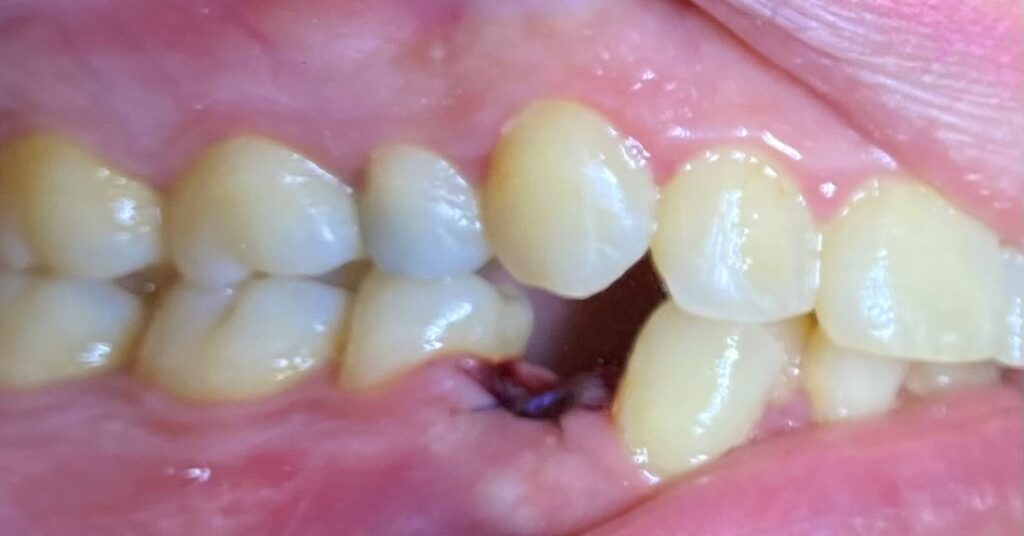 ορθοδοντική ενηλίκων